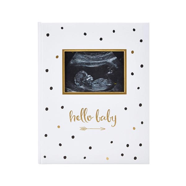 *Pearhead "Hello Baby" Sonogram Baby Book