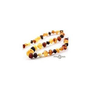 *Healing Amber - Stretch- Amber Infant Bracelet/Anklet - 6.5"